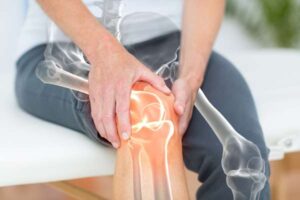 Kiedy niezbędna jest operacja zwyrodnienia kolana?